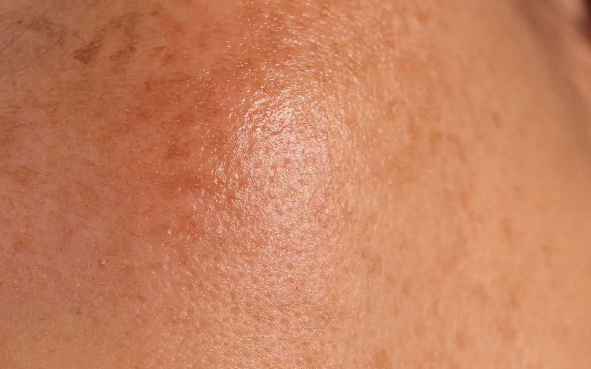 Comment affiner son grain de peau et retrouver de l’éclat ?