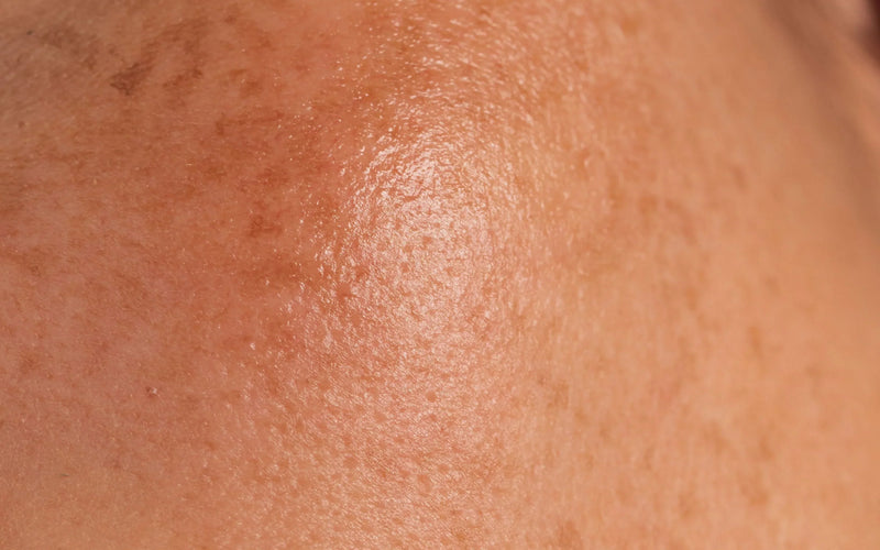 Comment affiner son grain de peau et retrouver de l’éclat ?