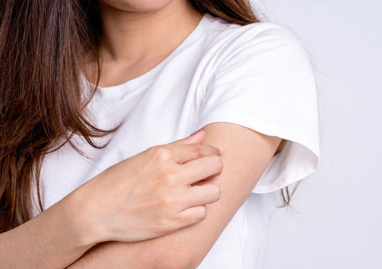 Eczéma : Origines & Remèdes naturels - Les Petits Prödiges