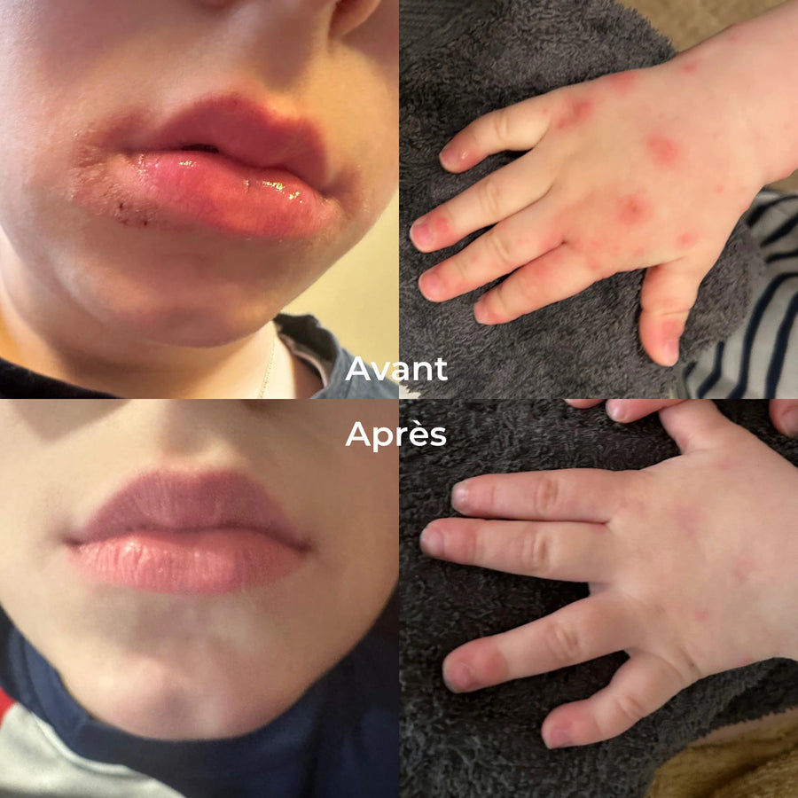 100% ont observé une amélioration visible de l’aspect de leur peau.*
