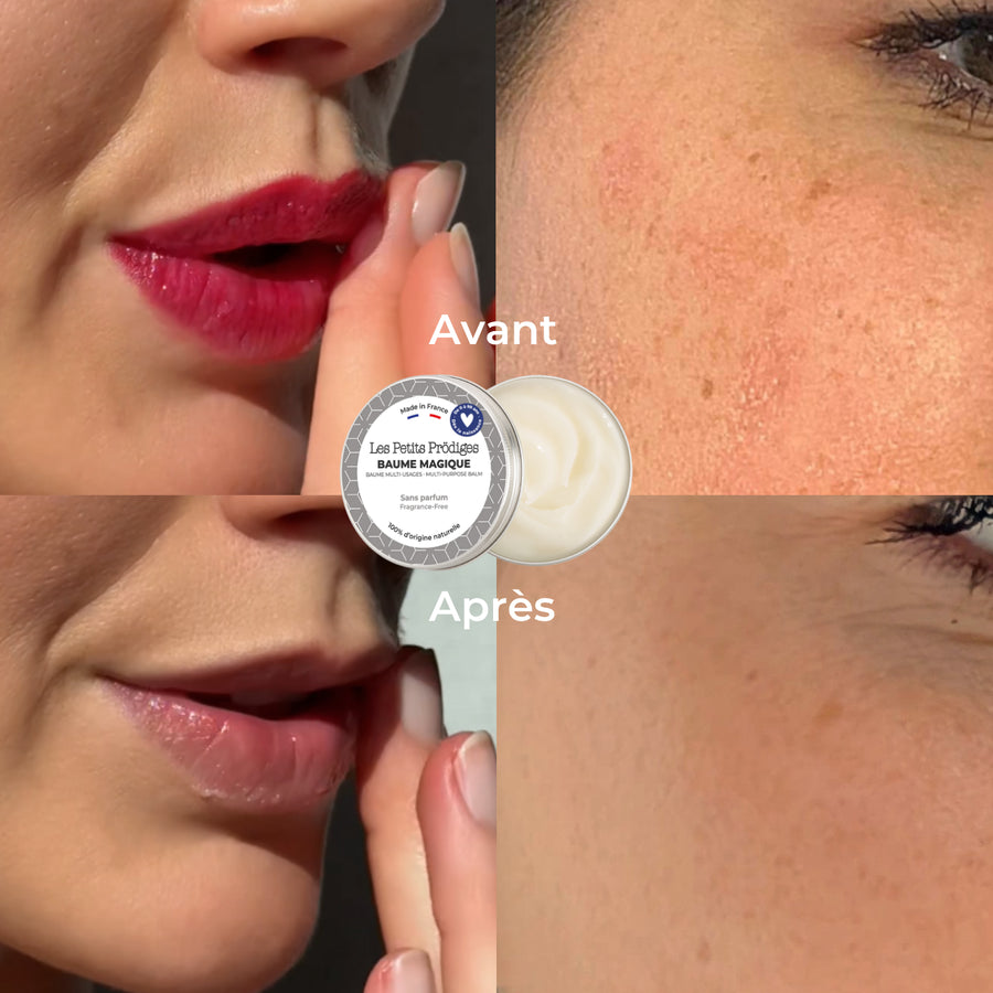 avant/après baume magique