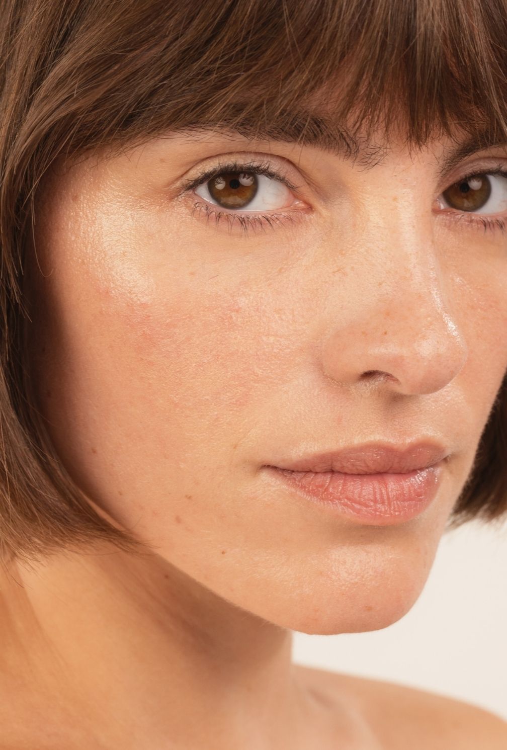 Dry & dehydrated skin