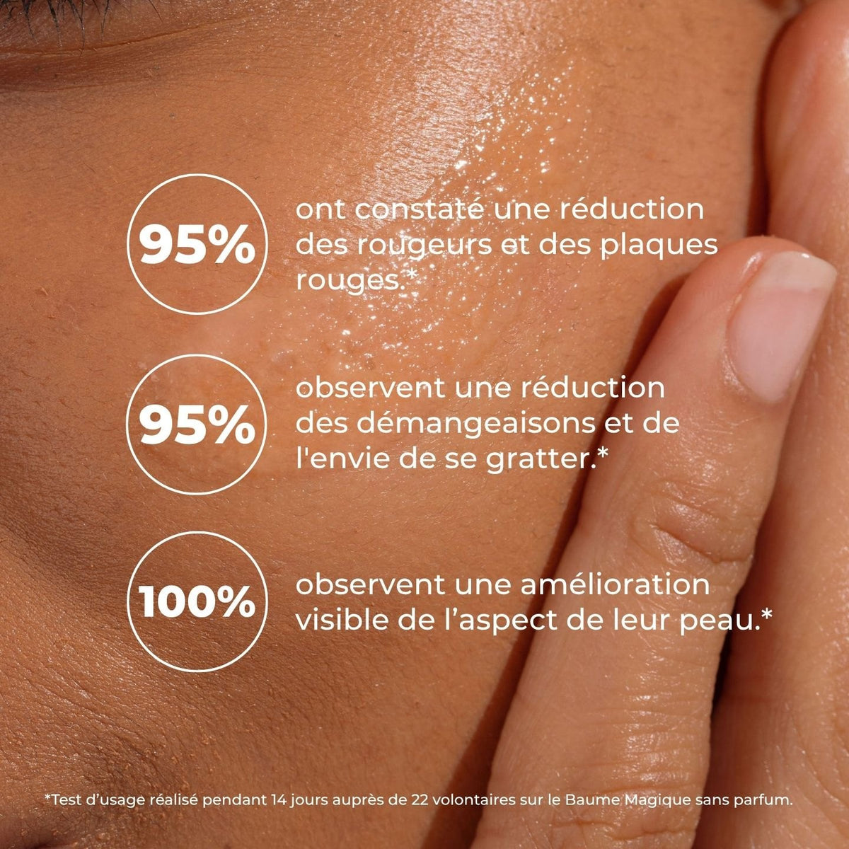 Peau brillante de baume : 95 % réduction des rougeurs, 95 % des démangeaisons, 100 % amélioration visible
