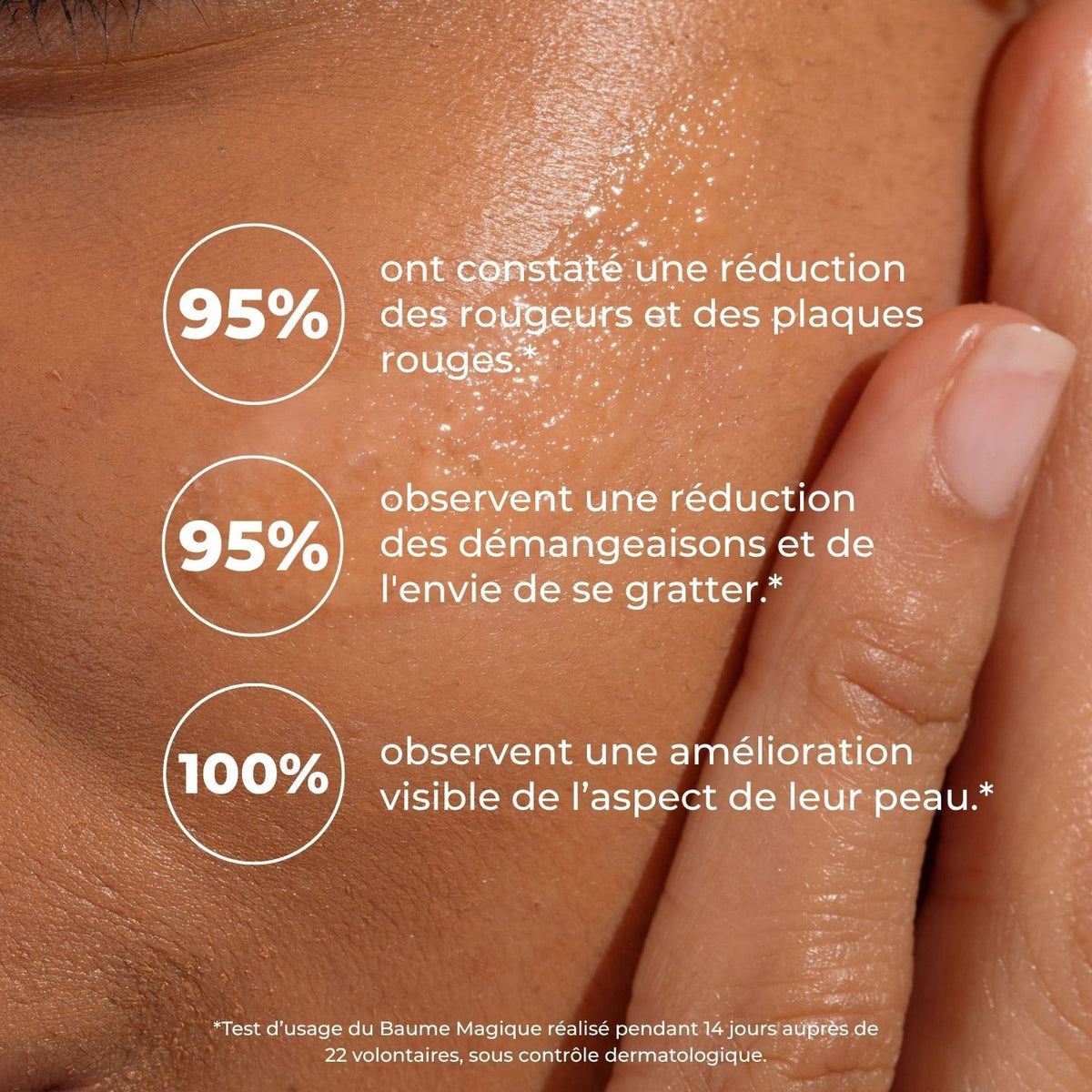 Peau brillante de baume : 95 % réduction des rougeurs, 95 % des démangeaisons, 100 % amélioration visible