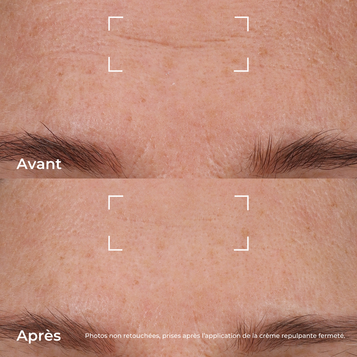 Avant/après application de la Crème Repulpante Fermeté, montrant l’effet lissant sur les rides du front. Photos non retouchées.