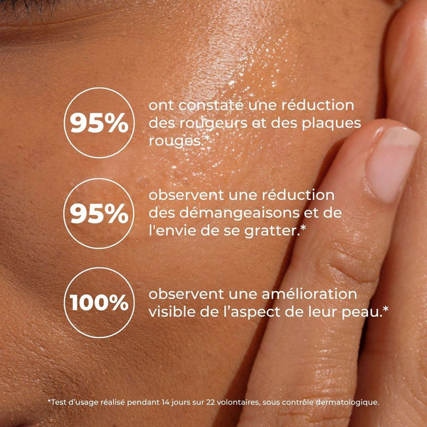 Peau brillante de baume : 95 % réduction des rougeurs, 95 % des démangeaisons, 100 % amélioration visible