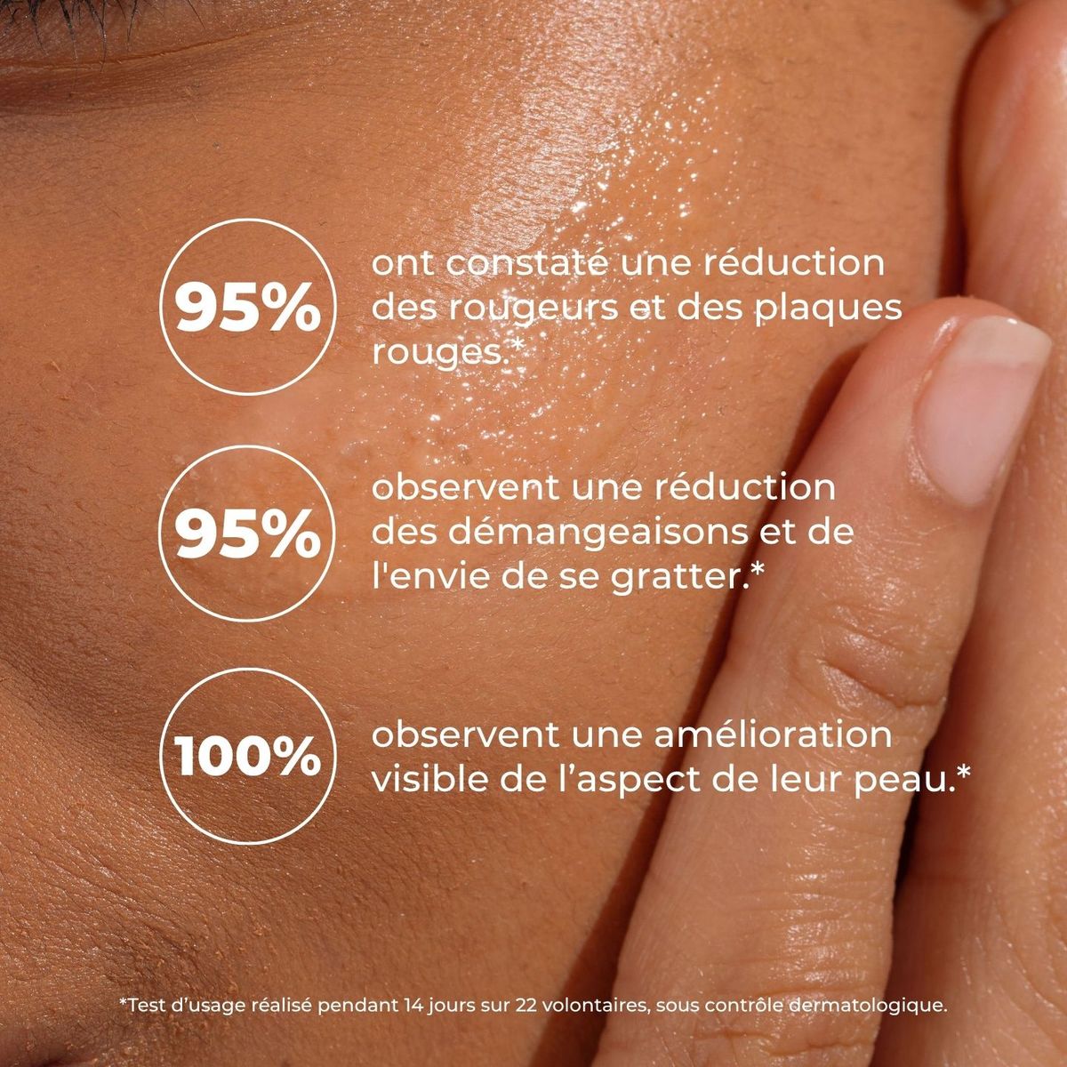 Peau brillante de baume : 95 % réduction des rougeurs, 95 % des démangeaisons, 100 % amélioration visible