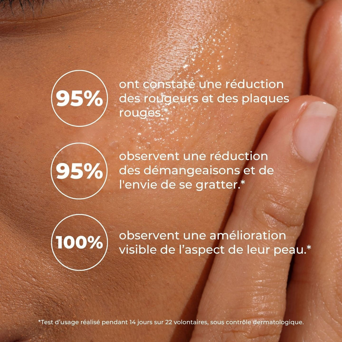 Peau brillante de baume : 95 % réduction des rougeurs, 95 % des démangeaisons, 100 % amélioration visible