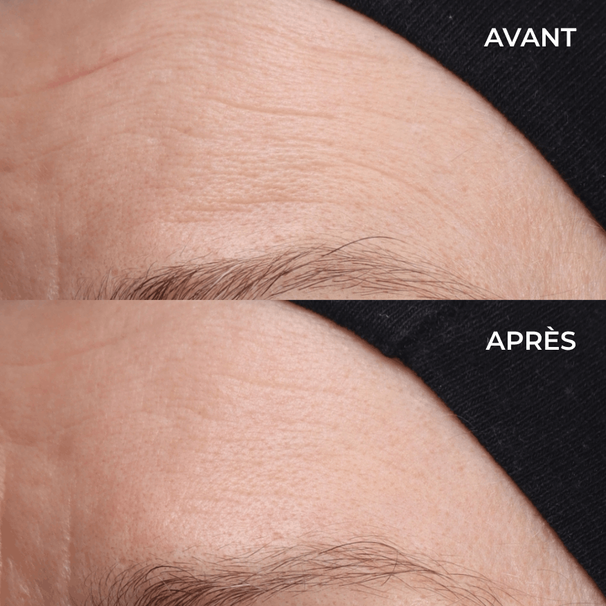 Test cutané du Sérum Repulpant Fermeté Les Petites Prödiges sur le visage